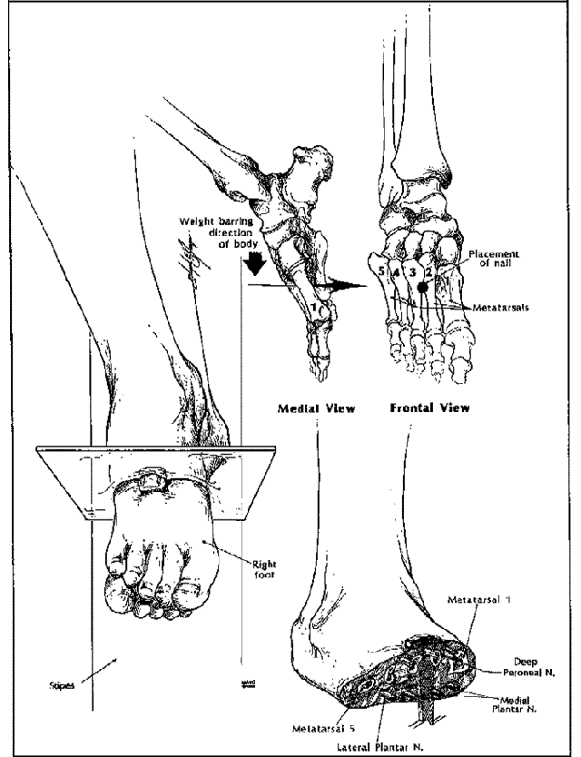 JAMA4